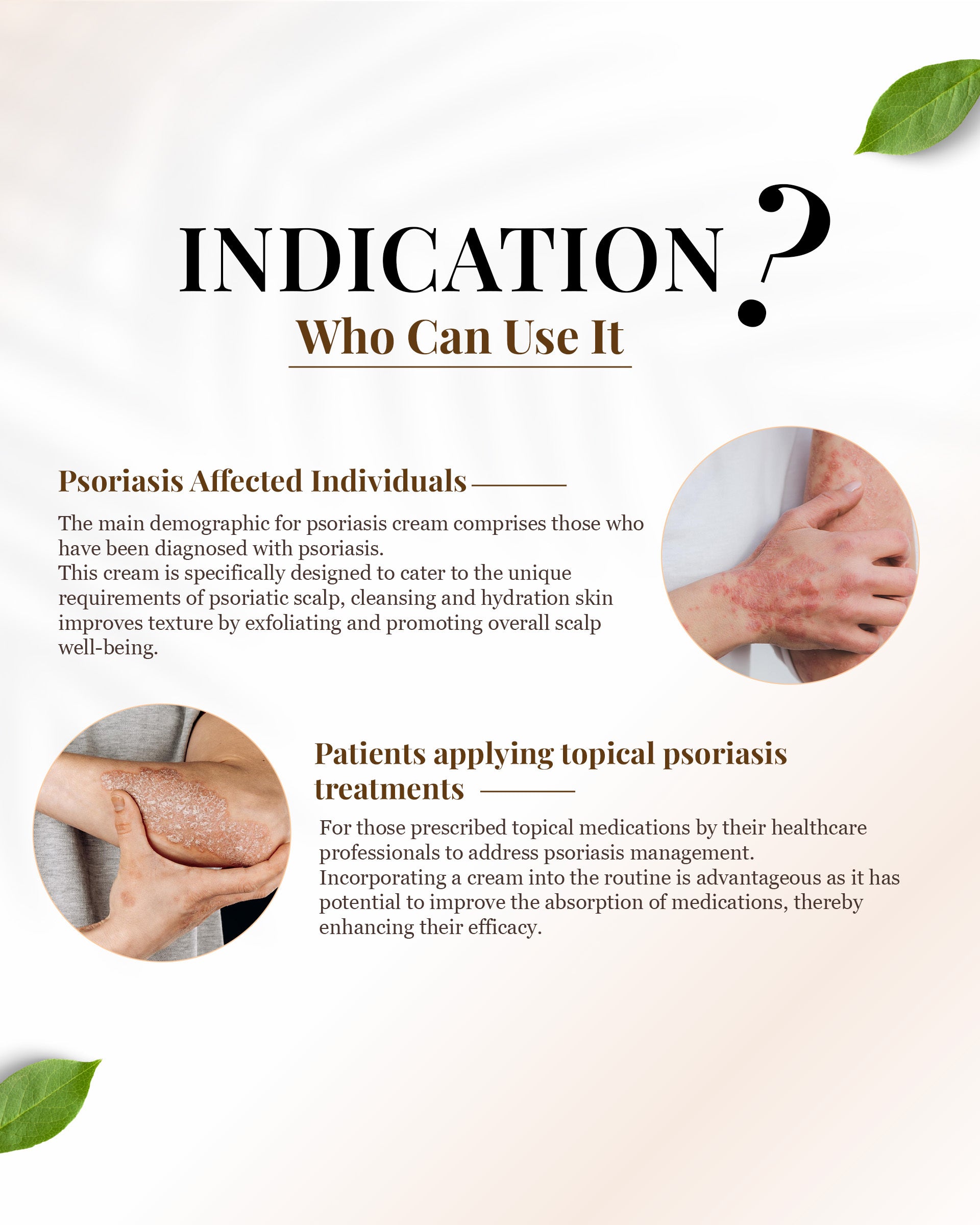 Siya Ayurveda Psoria Cream: Cream for psoriasis