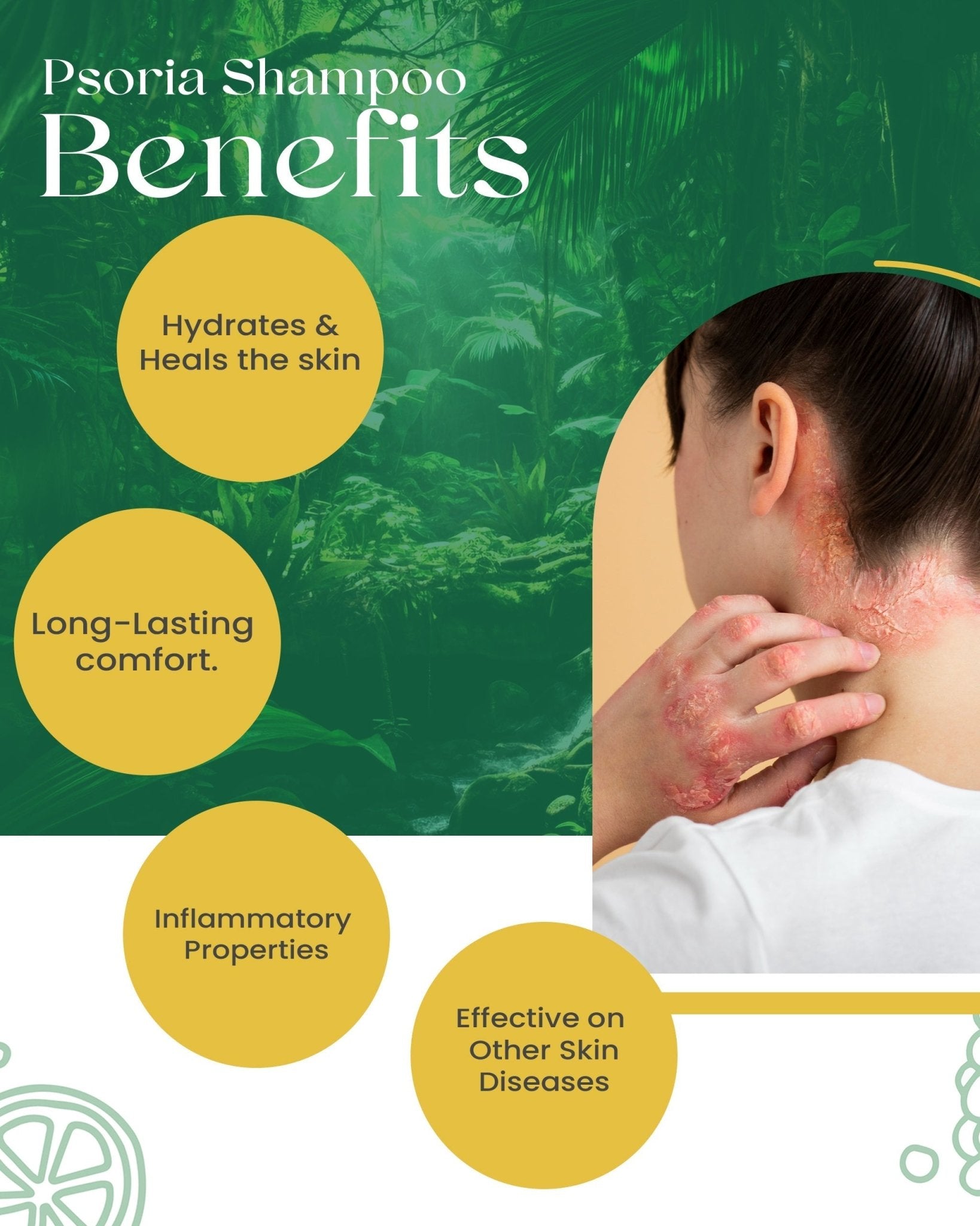 Psoriasis Shampoo: Siya Ayurveda Psoria Shampoo - Siya Ayurveda