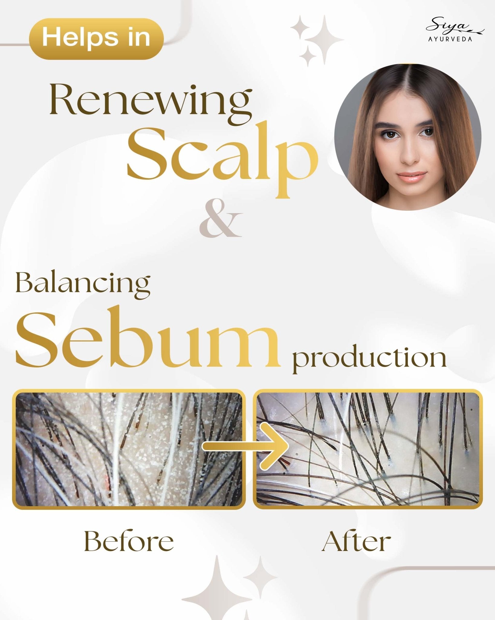 Scalp Exfoliating Serum (Anti - Dandruff Serum) - Siya Ayurveda
