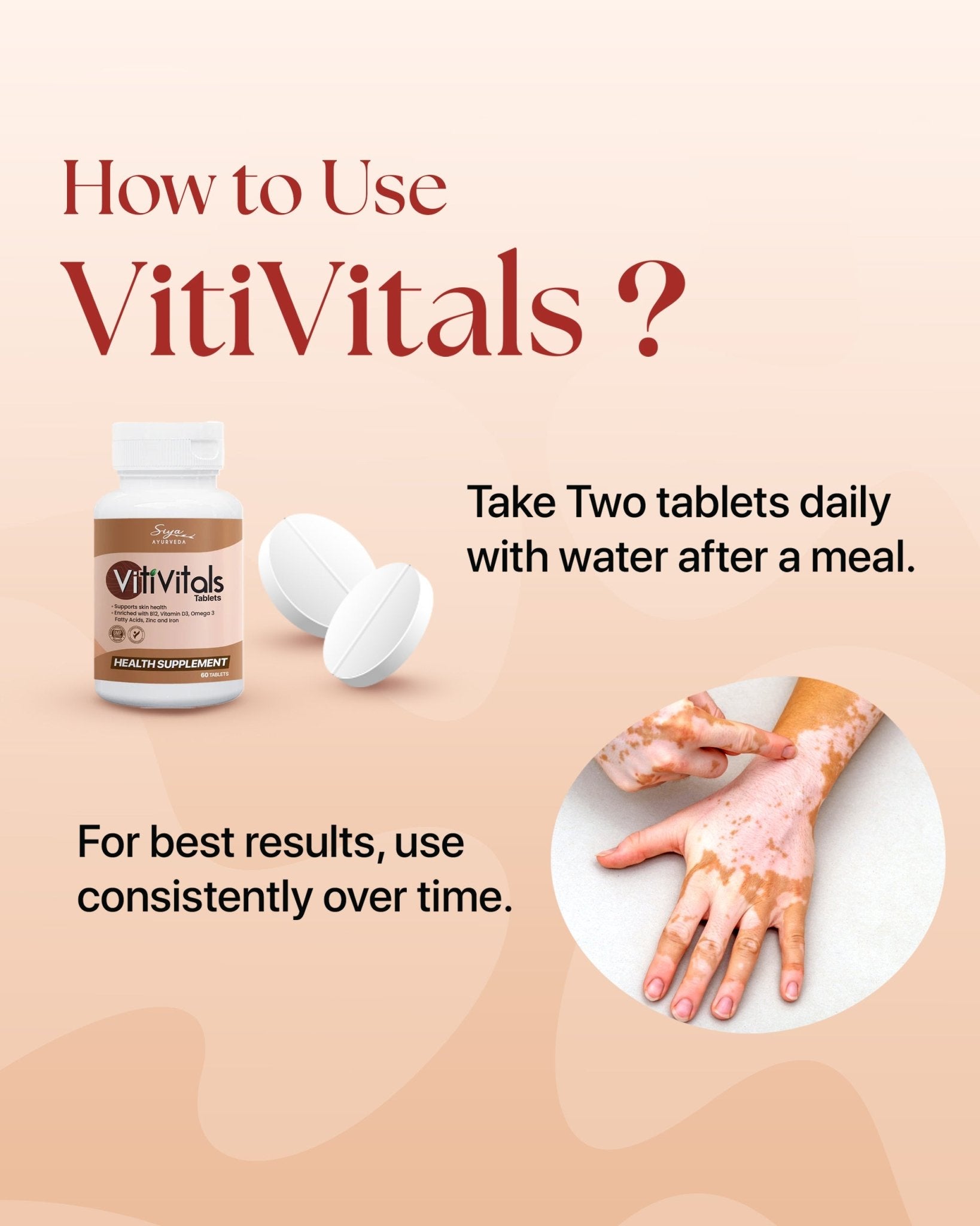 Vitivitals Tablets | Vitiligo Treatment Solution - Siya Ayurveda