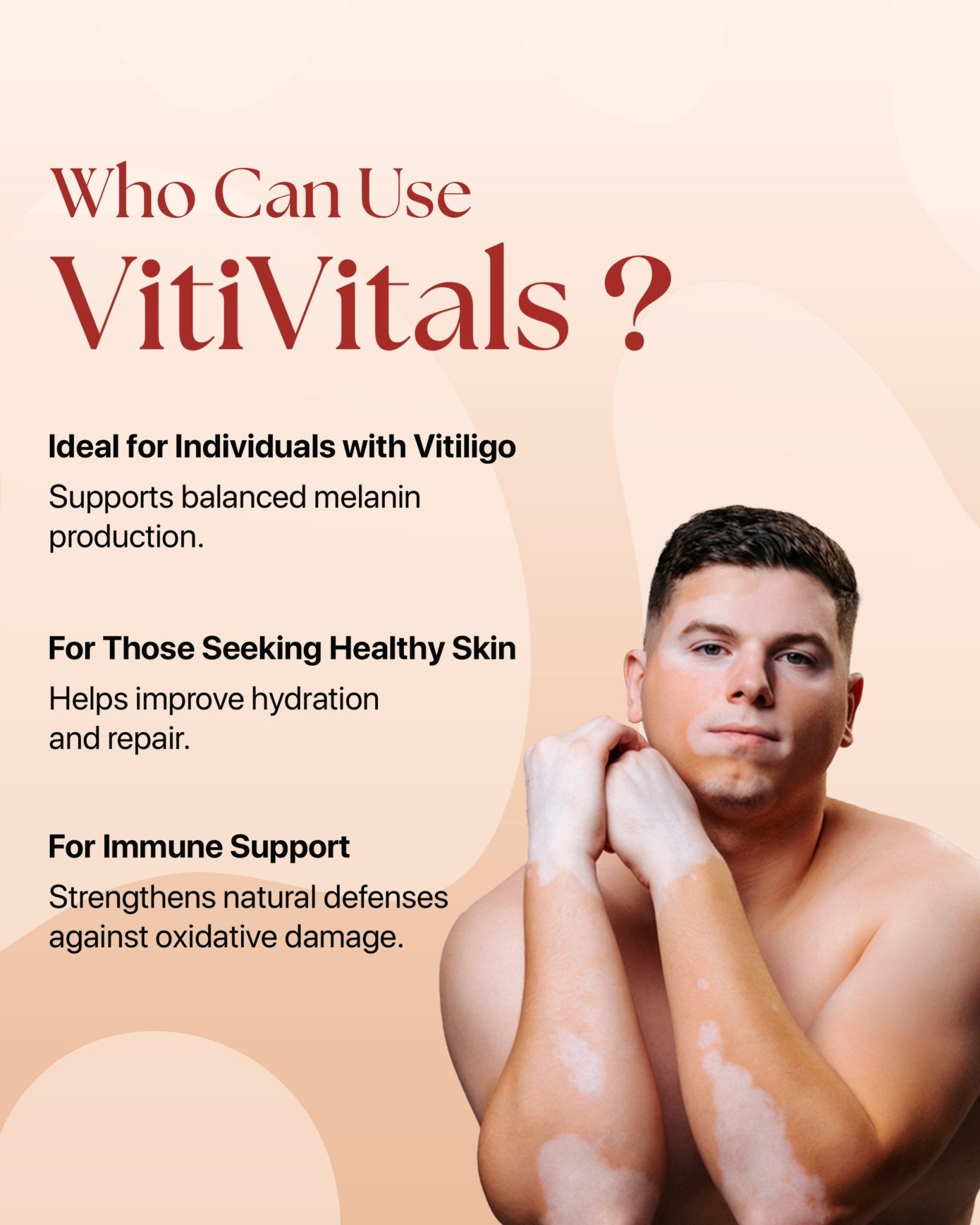 Vitivitals Tablets | Vitiligo Treatment Solution - Siya Ayurveda