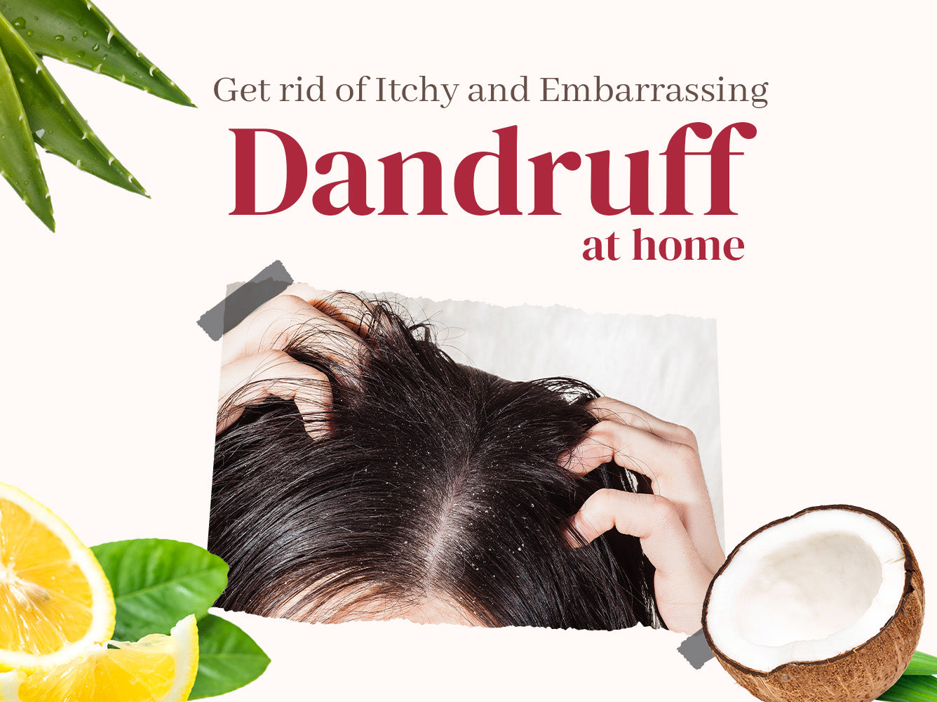 Homemade Treatments for Itchy Dandruff