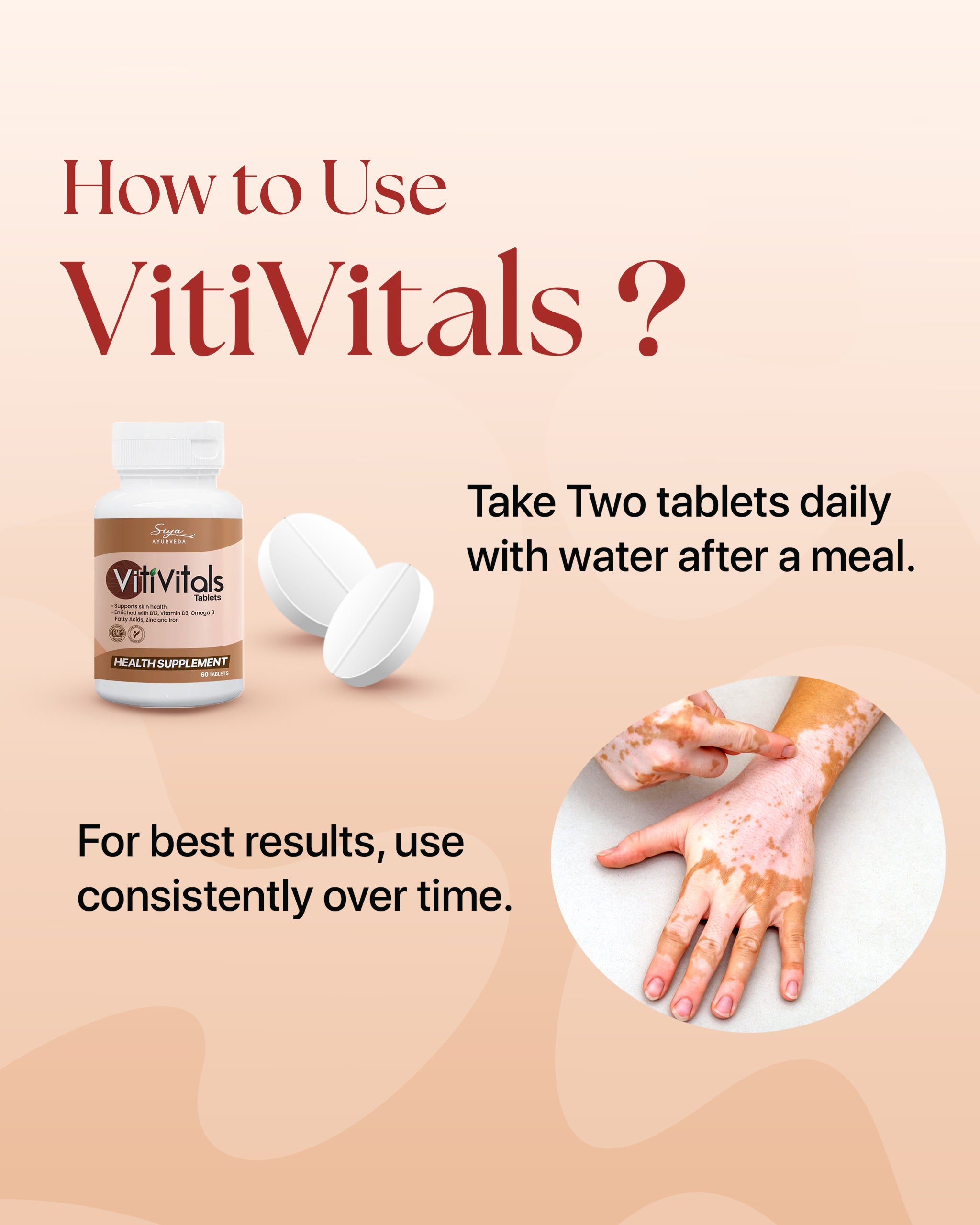 Vitivitals Tablets | Vitiligo Treatment Solution